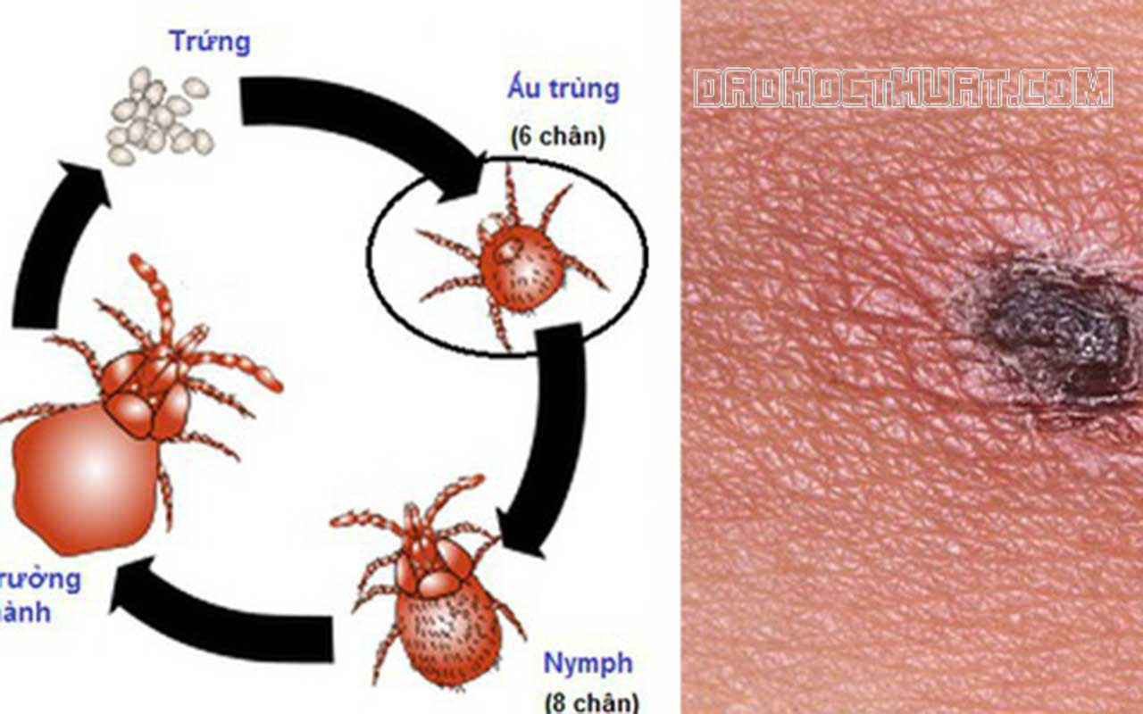 Mò là con gì? Bệnh sốt mò là gì? Cách phòng tránh bệnh